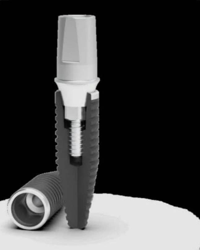 MESA IGEA IMPLANTAT | PERFEKTIONISTISCHES ÄSTHETISCHES DESIGN